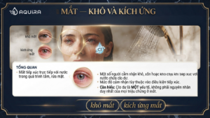 Mắt tiếp xúc bị khô và kích ứng.